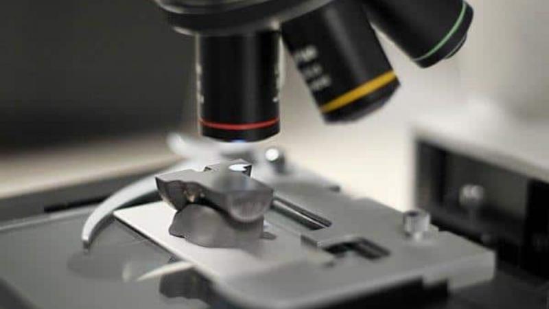 Valor do Teste de Resistência: Entenda Aqui